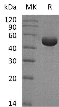 BL-0645NP: Greater than 95% as determined by reducing SDS-PAGE. (QC verified)Recombinant Human SHMT1 Protein (C-6His)