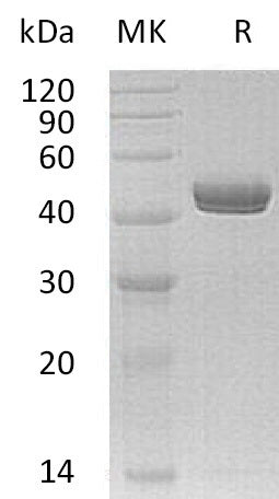 BL-0640NP: Greater than 95% as determined by reducing SDS-PAGE. (QC verified)Recombinant Human NTNG1 Protein (C-6His)