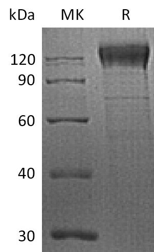 BL-2244NP: Greater than 90% as determined by reducing SDS-PAGE. (QC verified)Recombinant Human ITGB1 Protein (C-6His)