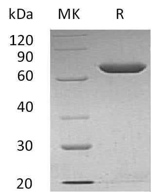 BL-1358NP: Greater than 95% as determined by reducing SDS-PAGE. (QC verified)Recombinant Human Calnexin Protein (C-6His)