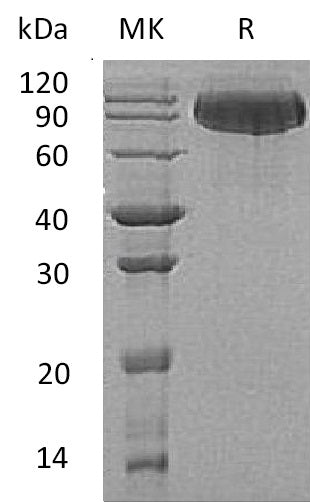 BL-1357NP: Greater than 95% as determined by reducing SDS-PAGE. (QC verified)Recombinant Human BCHE Protein (C-6His)