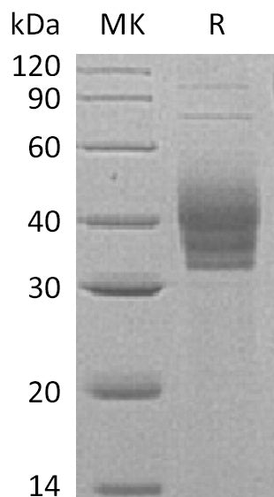 BL-0555NP: Greater than 95% as determined by reducing SDS-PAGE. (QC verified)Recombinant Human Cerberus1 Protein (C-6His)