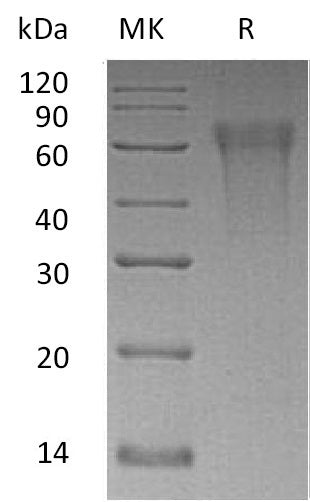 BL-0550NP: Greater than 95% as determined by reducing SDS-PAGE. (QC verified)Recombinant Human CLM9 Protein (C-6His)