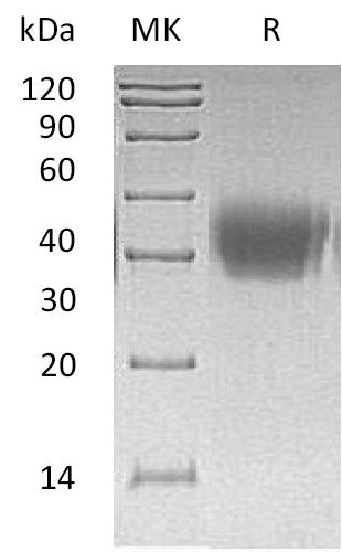 BL-1217NP: Greater than 95% as determined by reducing SDS-PAGE. (QC verified)Recombinant Human ACVR2A Protein (C-6His)