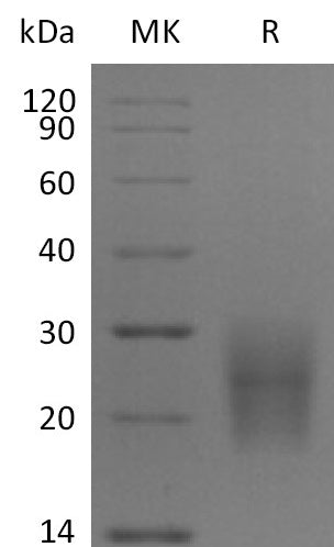 BL-1215NP: Greater than 95% as determined by reducing SDS-PAGE. (QC verified)Recombinant Human CD3D Protein (C-6His)