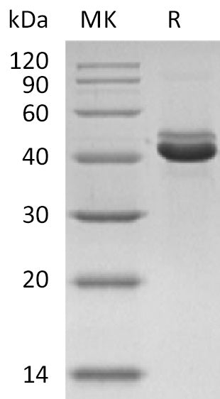 BL-2171NP: Greater than 95% as determined by reducing SDS-PAGE. (QC verified)Recombinant Human CD5L Protein (C-6His)