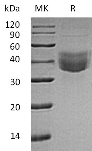BL-0558NP: Greater than 90% as determined by reducing SDS-PAGE. (QC verified)Recombinant Human CLEC10A Protein (C-6His)