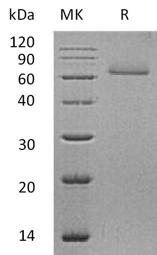 BL-0560NP: Greater than 95% as determined by reducing SDS-PAGE. (QC verified)Recombinant Human CDSN Protein (C-6His)