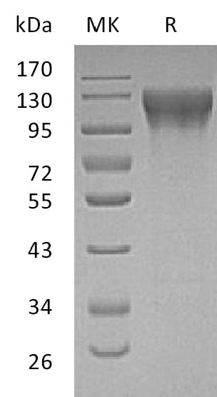 BL-2009NP: Greater than 95% as determined by reducing SDS-PAGE. (QC verified)Recombinant Human ECE-1 Protein (N-8His)