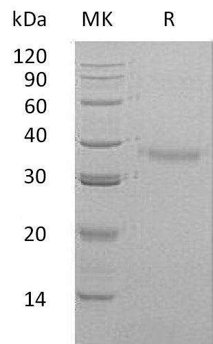 BL-0563NP: Greater than 95% as determined by reducing SDS-PAGE. (QC verified)Recombinant Human CRHBP Protein (C-6His)