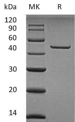 BL-0562NP: Greater than 95% as determined by reducing SDS-PAGE. (QC verified)Recombinant Human CPA2 Protein (C-6His)