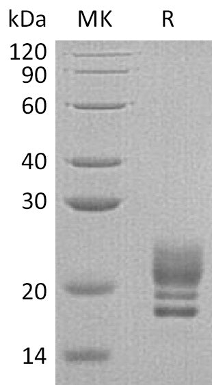 BL-0561NP: Greater than 95% as determined by reducing SDS-PAGE. (QC verified)Recombinant Human COQ7 Protein (C-6His)