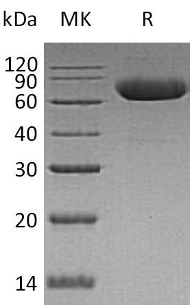 BL-0570NP: Greater than 90% as determined by reducing SDS-PAGE. (QC verified)Recombinant Human LRRTM2 Protein (C-6His)