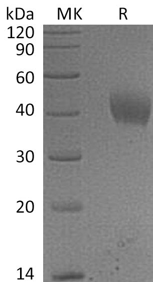 BL-0569NP: Greater than 95% as determined by reducing SDS-PAGE. (QC verified)Recombinant Human IL-20RA Protein (C-6His)