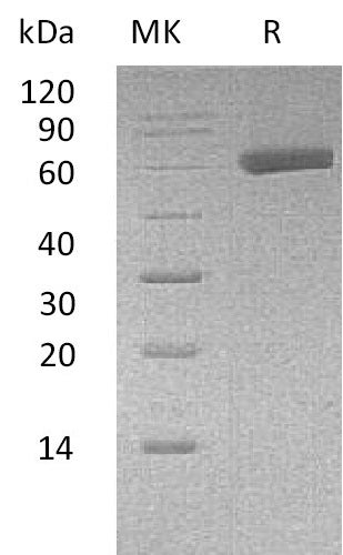 BL-0566NP: Greater than 95% as determined by reducing SDS-PAGE. (QC verified)Recombinant Human EDIL3 Protein (C-6His)