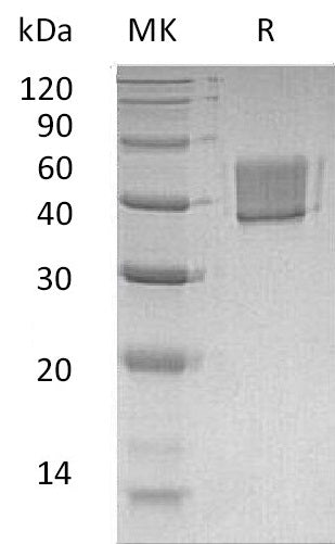 BL-0567NP: Greater than 95% as determined by reducing SDS-PAGE. (QC verified)Recombinant Human FcRL1 Protein (C-6His)