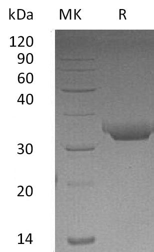 BL-1363NP: Greater than 95% as determined by reducing SDS-PAGE. (QC verified)Recombinant Human PRTN3 Protein (C-6His)