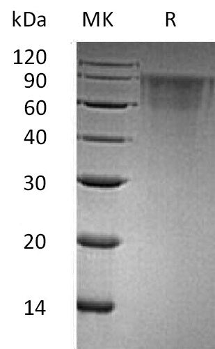 BL-0581NP: Greater than 95% as determined by reducing SDS-PAGE. (QC verified)Recombinant Human THSD1 Protein (C-6His)