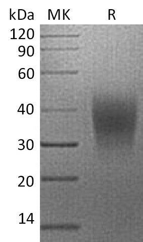 BL-2242NP: Greater than 95% as determined by reducing SDS-PAGE. (QC verified)Recombinant Human VISTA Protein (C-6His)