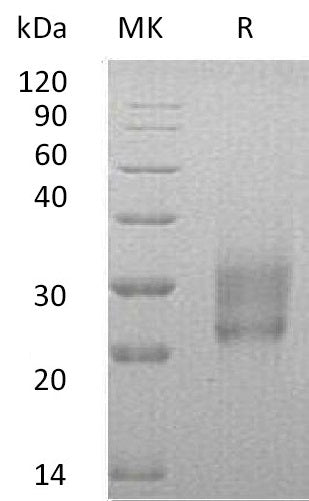 BL-0580NP: Greater than 95% as determined by reducing SDS-PAGE. (QC verified)Recombinant Human HAI-2 Protein (C-6His)