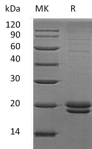 BL-0582NP: Greater than 85% as determined by reducing SDS-PAGE. (QC verified)Recombinant Human VMO1 Protein (C-6His)
