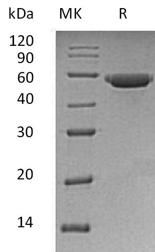 BL-1365NP: Greater than 95% as determined by reducing SDS-PAGE. (QC verified)Recombinant Human LIPF Protein (C-6His)