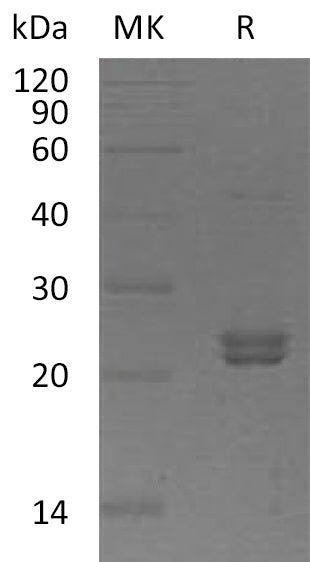BL-1368NP: Greater than 95% as determined by reducing SDS-PAGE. (QC verified)Recombinant Human ST6GalNAc2 Protein (C-6His)
