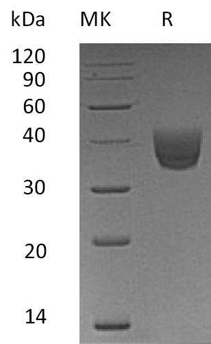 BL-0590NP: Greater than 95% as determined by reducing SDS-PAGE. (QC verified)Recombinant Human CD157 Protein (C-6His)