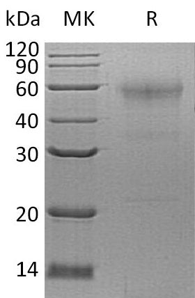 BL-0595NP: Greater than 90% as determined by reducing SDS-PAGE. (QC verified)Recombinant Human SPESP1 Protein (C-6His)