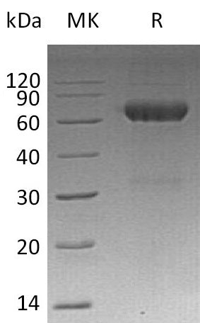 BL-1374NP: Greater than 95% as determined by reducing SDS-PAGE. (QC verified)Recombinant Mouse MMP-12 Protein (C-6His)