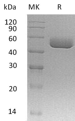 BL-1373NP: Greater than 95% as determined by reducing SDS-PAGE. (QC verified)Recombinant Mouse Serpin A1a Protein (C-6His, AAC28869.1)