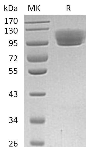 BL-0021NP: Greater than 95% as determined by reducing SDS-PAGE. (QC verified)Recombinant Human ROBO4 Protein (C-Fc)