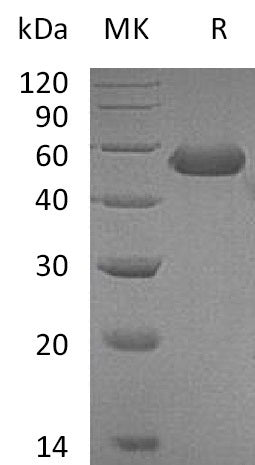BL-0612NP: Greater than 95% as determined by reducing SDS-PAGE. (QC verified)Recombinant Mouse CD5L Protein (C-6His)