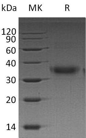 BL-0614NP: Greater than 95% as determined by reducing SDS-PAGE. (QC verified)Recombinant Human FOLR1 Protein (C-6His)