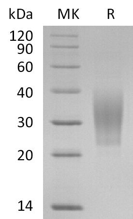 BL-0624NP: Greater than 95% as determined by reducing SDS-PAGE. (QC verified)Recombinant Human TREM-2 Protein (C-6His)