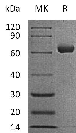 BL-0025NP: Greater than 95% as determined by reducing SDS-PAGE. (QC verified)Recombinant Human IGSF11 Protein (C-Fc)