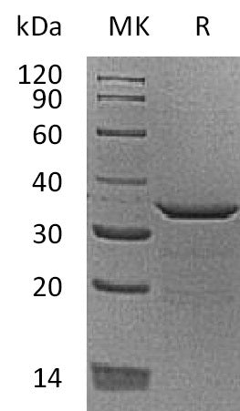 BL-0625NP: Greater than 95% as determined by reducing SDS-PAGE. (QC verified)Recombinant Human PDYN Protein (C-6His)
