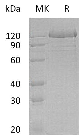 BL-0628NP: Greater than 95% as determined by reducing SDS-PAGE. (QC verified)Recombinant Human PCDH1 Protein (C-6His)
