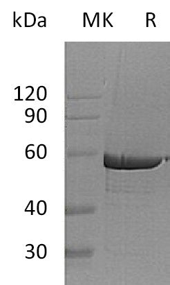 BL-1384NP: Greater than 95% as determined by reducing SDS-PAGE. (QC verified)Recombinant Human G6PD Protein (C-6His)