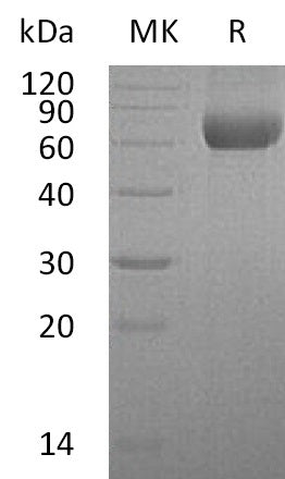 BL-1381NP: Greater than 95% as determined by reducing SDS-PAGE. (QC verified)Recombinant Human HATL5 Protein (C-6His)