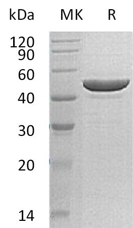 BL-0627NP: Greater than 95% as determined by reducing SDS-PAGE. (QC verified)Recombinant Human RRM2 Protein (C-6His)