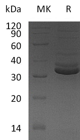 BL-1386NP: Greater than 95% as determined by reducing SDS-PAGE. (QC verified)Recombinant Human GPD1 Protein (C-6His)