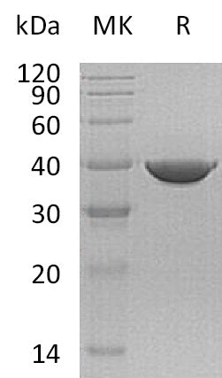 BL-1387NP: Greater than 95% as determined by reducing SDS-PAGE. (QC verified)Recombinant Human TALDO1 Protein (C-6His)