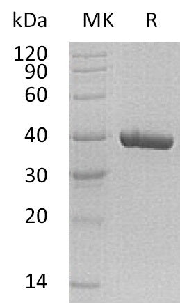 BL-1382NP: Greater than 95% as determined by reducing SDS-PAGE. (QC verified)Recombinant Human Carbonic Anhydrase 11 Protein (C-6His)
