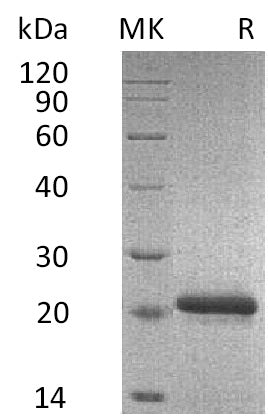 BL-1446NP: Greater than 95% as determined by reducing SDS-PAGE. (QC verified)Recombinant Mouse TIMP-2 Protein (C-6His)