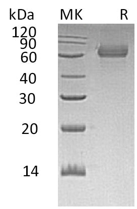 BL-0758NP: Greater than 95% as determined by reducing SDS-PAGE. (QC verified)Recombinant Human TGOLN2 Protein (C-6His)