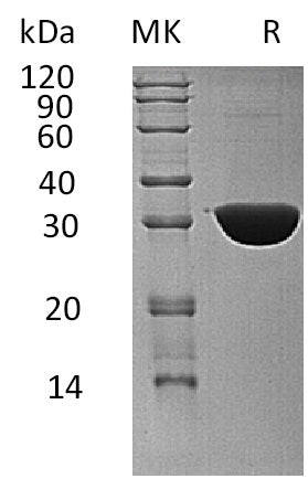 BL-1443NP: Greater than 95% as determined by reducing SDS-PAGE. (QC verified)Recombinant Human KHK Protein (C-6His)