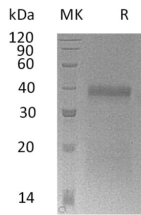 BL-0757NP: Greater than 90% as determined by reducing SDS-PAGE. (QC verified)Recombinant Mouse IGFBP-5 Protein (C-6His)