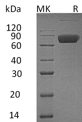 BL-0047NP: Greater than 95% as determined by reducing SDS-PAGE. (QC verified)Recombinant Human IL-10RB Protein (C-Fc)