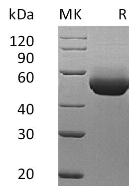 BL-1238NP: Greater than 95% as determined by reducing SDS-PAGE. (QC verified)Recombinant Mouse IL-5RA Protein (C-6His)